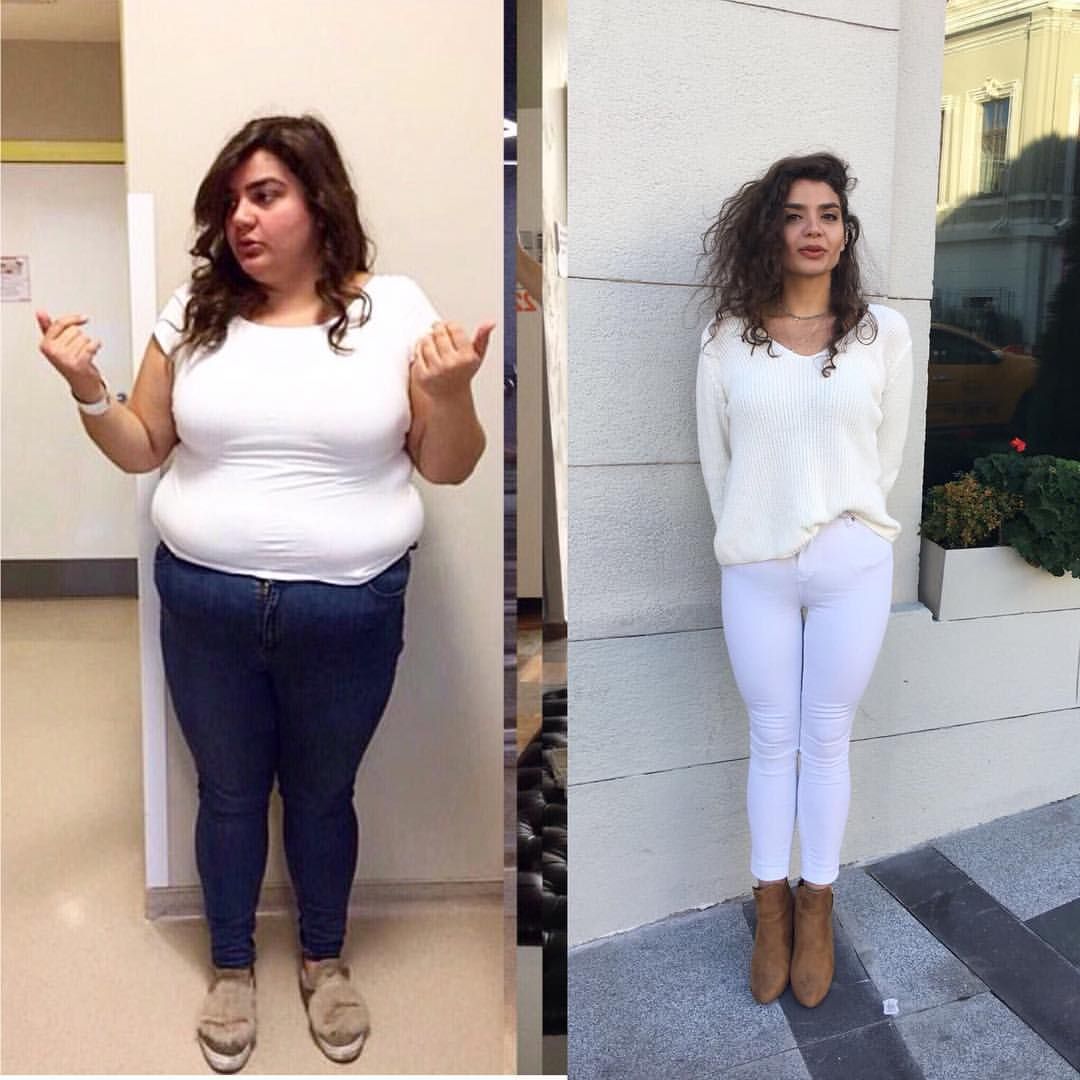 Lauren's before and after photos